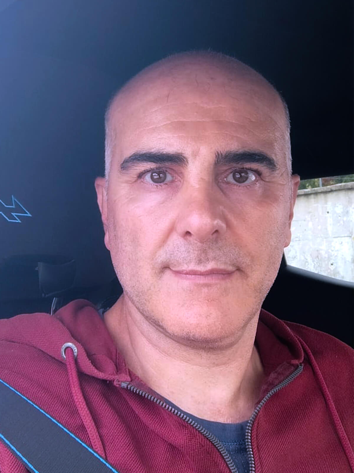 Atilla AKÇAY